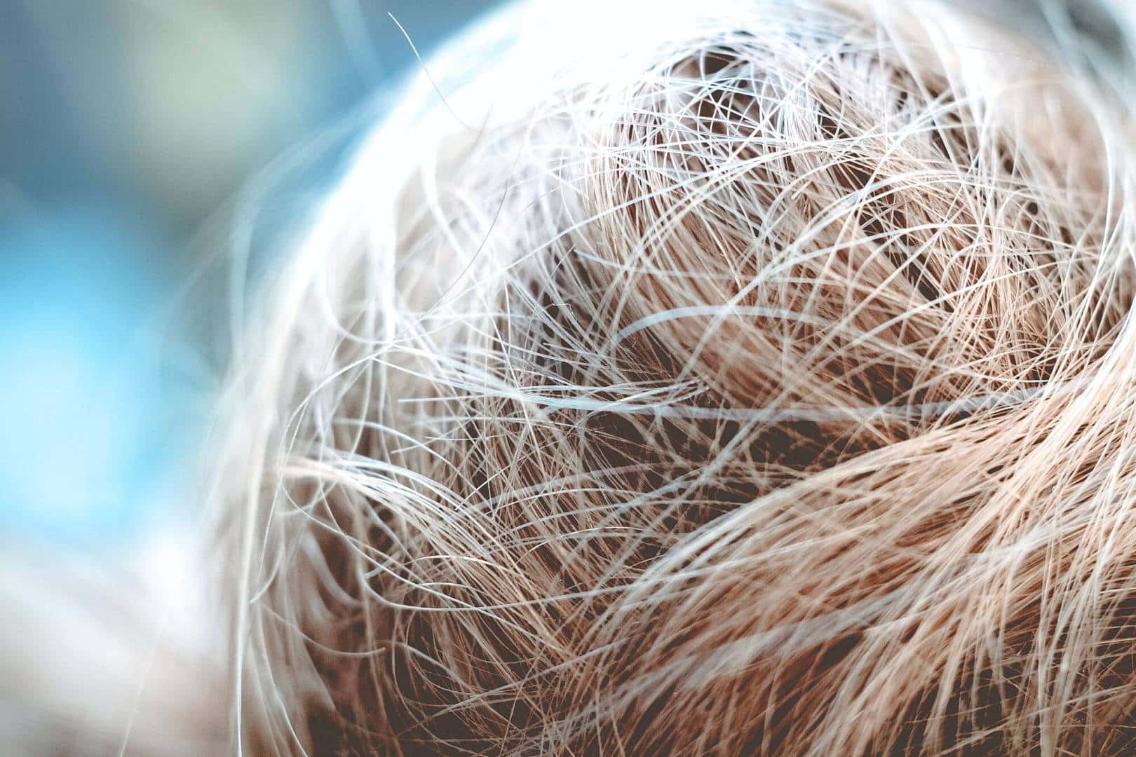 Najczęstsze problemy z włosami i jak je rozwiązać – porady trychologa